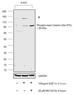 Phospho-beta Catenin (Ser675) Antibody in Western Blot (WB)