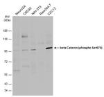 Phospho-beta Catenin (Ser675) Antibody in Western Blot (WB)