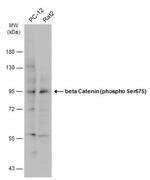 Phospho-beta Catenin (Ser675) Antibody in Western Blot (WB)