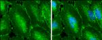 beta Catenin Antibody in Immunocytochemistry (ICC/IF)