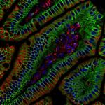 beta Catenin Antibody in Immunohistochemistry (Paraffin) (IHC (P))