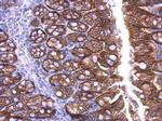 beta Catenin Antibody in Immunohistochemistry (Paraffin) (IHC (P))