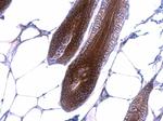 beta Catenin Antibody in Immunohistochemistry (Paraffin) (IHC (P))