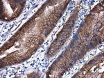 beta Catenin Antibody in Immunohistochemistry (Paraffin) (IHC (P))