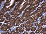 beta Catenin Antibody in Immunohistochemistry (Paraffin) (IHC (P))