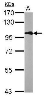 beta Catenin Antibody in Western Blot (WB)