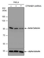 beta Catenin Antibody