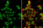 DNMT3A Antibody in Immunocytochemistry (ICC/IF)