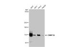 DNMT3A Antibody in Western Blot (WB)