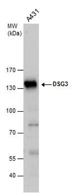 Desmoglein 3 Antibody in Western Blot (WB)