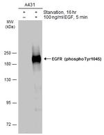 Phospho-EGFR (Tyr1045) Antibody in Western Blot (WB)