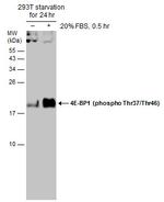 Phospho-4EBP1 (Thr37, Thr46) Antibody in Western Blot (WB)