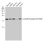 Phospho-4EBP1 (Thr37, Thr46) Antibody in Western Blot (WB)