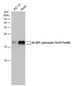 Phospho-4EBP1 (Thr37, Thr46) Antibody in Western Blot (WB)