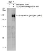 Phospho-ErbB2 (HER-2) (Tyr877) Antibody in Western Blot (WB)