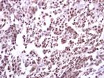 ERCC1 Antibody in Immunohistochemistry (Paraffin) (IHC (P))