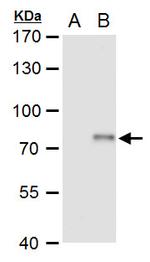 XPD Antibody in Western Blot (WB)