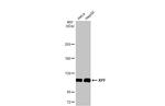 XPF Antibody in Western Blot (WB)