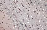 ETV1 Antibody in Immunohistochemistry (Paraffin) (IHC (P))