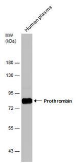 Prothrombin Antibody in Western Blot (WB)