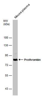 Prothrombin Antibody in Western Blot (WB)