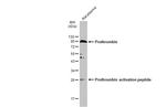 Prothrombin Antibody in Western Blot (WB)