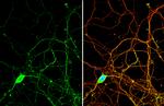 PYK2 Antibody in Immunocytochemistry (ICC/IF)