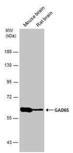 GAD65 Antibody in Western Blot (WB)