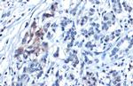 Glypican 3 Antibody in Immunohistochemistry (Paraffin) (IHC (P))