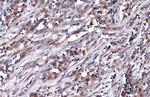 GLO1 Antibody in Immunohistochemistry (Paraffin) (IHC (P))