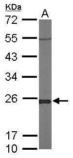 GLO1 Antibody in Western Blot (WB)