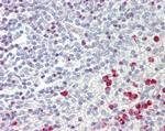 GNAQ Antibody in Immunohistochemistry (Paraffin) (IHC (P))