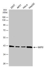 GOT2 Antibody in Western Blot (WB)