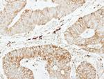 GSTP1 Antibody in Immunohistochemistry (Paraffin) (IHC (P))