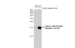 Phospho-Histone H2A.X (Ser139) Antibody in Western Blot (WB)