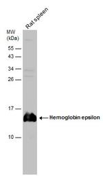 HBE1 Antibody in Western Blot (WB)