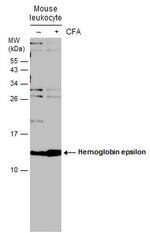 HBE1 Antibody in Western Blot (WB)