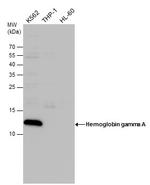 Hemoglobin gamma A Antibody in Western Blot (WB)