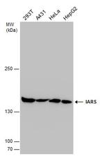 IARS Antibody in Western Blot (WB)