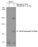 Phospho-IGF1R beta (Tyr1316) Antibody in Western Blot (WB)