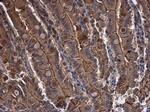 CYR61 Antibody in Immunohistochemistry (Paraffin) (IHC (P))