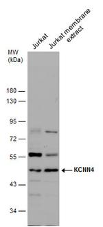 KCNN4 Antibody in Western Blot (WB)