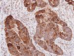 CD171 (L1CAM) Antibody in Immunohistochemistry (Paraffin) (IHC (P))