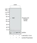 Phospho-LCK (Tyr394) Antibody