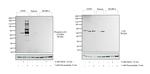 Phospho-LCK (Tyr394) Antibody in Western Blot (WB)