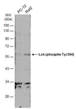 Phospho-LCK (Tyr394) Antibody in Western Blot (WB)