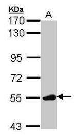 LCK Antibody in Western Blot (WB)