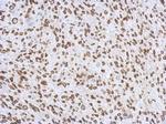 Lamin A/C Antibody in Immunohistochemistry (Paraffin) (IHC (P))