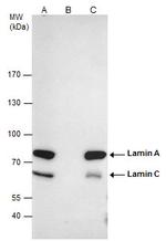 Lamin A/C Antibody in Immunoprecipitation (IP)