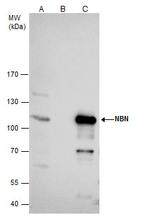 NBS1 Antibody in Immunoprecipitation (IP)